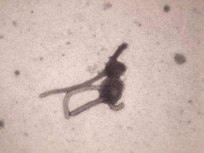 Φόβοι για κρούσμα Έμπολα στη Χαβάη