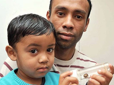 Βρετανία: Τετράχρονος πέρασε ένα μήνα με μια μπαταρία στη μύτη