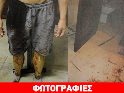 Φωτογραφίες-σοκ που δείχνουν τον Πιστόριους γεμάτο με το αίμα της συντρόφου του