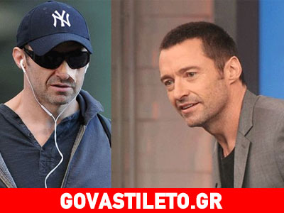 Χιου Τζάκμαν: Υπεβλήθη σε αφαίρεση καρκινώματος για τρίτη φορά