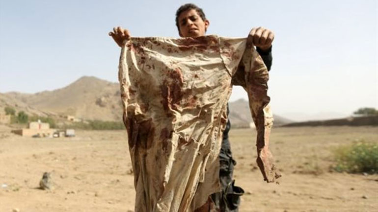 Υεμένη: Τους 944 έχουν φτάσει οι νεκροί από τις συγκρούσεις