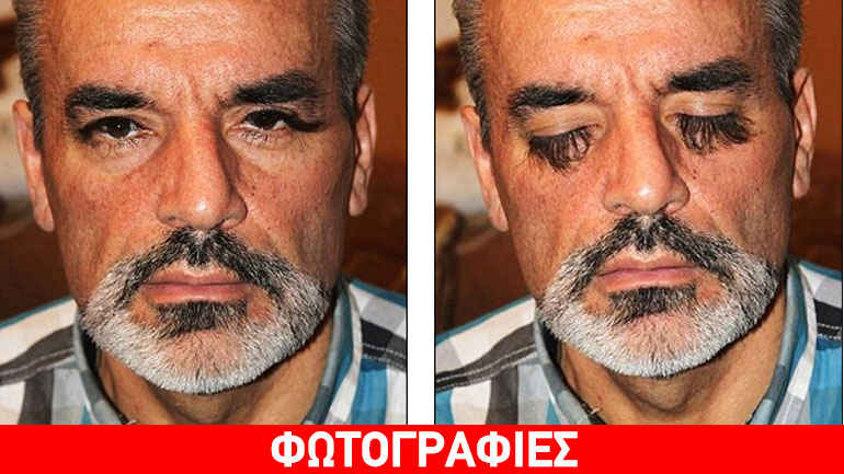 Ουκρανός ισχυρίζεται ότι έχει τις μεγαλύτερες βλεφαρίδες στον κόσμο