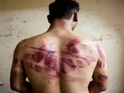 26 Ιουνίου: Παγκόσμια ημέρα στήριξης των θυμάτων βασανιστηρίων