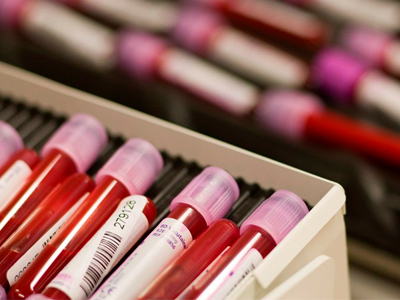 Πακιστάν: Το 20% όσων κάνουν τακτικές μεταγγίσεις αίματος έχει μολυνθεί από ηπατίτιδα ή AIDS