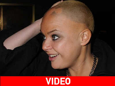 Κέρδισε τη μάχη με την αλωπεκία Κέρδισε τη μάχη με την αλωπεκία