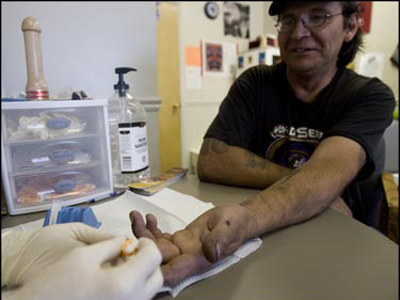 ΕΕ: Καμπανάκι για αύξηση κρουσμάτων HIV σε τοξικομανείς εξαιτίας της κρίσης