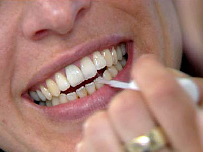 Οδοντιατρική φροντίδα: Μύθοι και αλήθειες