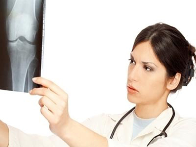 Οστεοπόρωση: Η πρόληψη είναι σημαντική