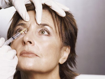 Botox: Πότε πρέπει να το ξεκινήσετε;