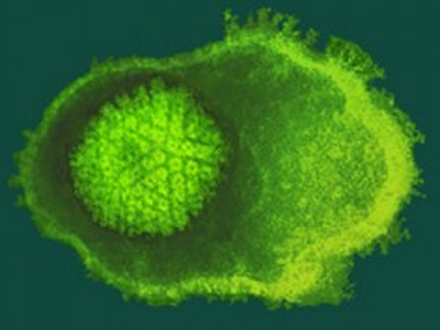 Έρπης ζωστήρ: Συμπτώματα και επιπλοκές