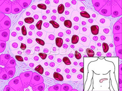 Η ανακάλυψη ομογενούς επιστήμονα
