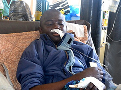 Ζάμπια: Γλύτωσε από τον πύθωνα δαγκώνοντάς τον