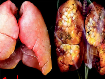 Πότε θα κόψουμε το κάπνισμα;