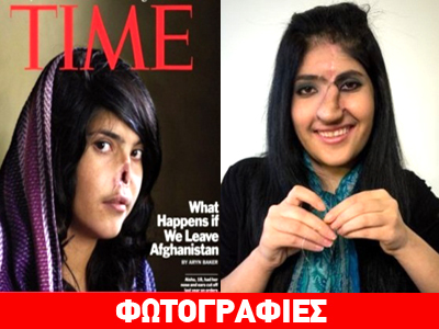 Νέο πρόσωπο για την κακοποιημένη Αφγανή