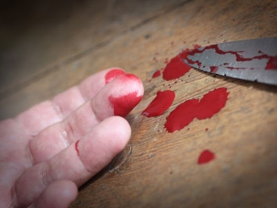 Ένας αποτυχημένος φόνος πάθους