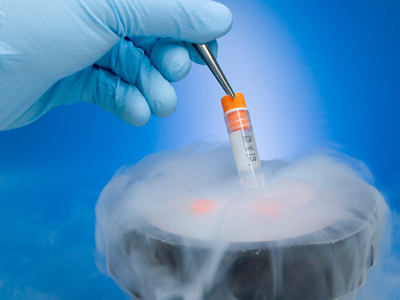 Η κρυοσυντήρηση των σπερματοζωαρίων αυξάνει την πιθανότητα πατρότητας μετά τον καρκίνο