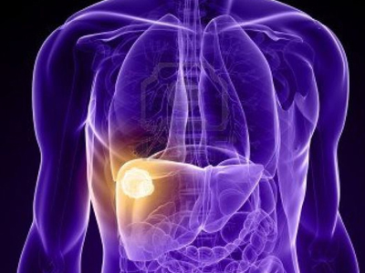 Γενετικά τροποποιημένος ιός δίνει ελπίδα σε καρκινοπαθείς