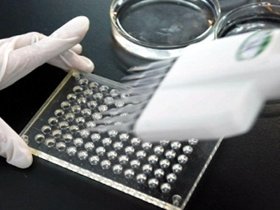 Παρίσι: Χιλιάδες φιαλίδια με τον ιό SARS χάθηκαν από το Ινστιτούτο Παστέρ Παρίσι: Χιλιάδες φιαλίδια με τον ιό SARS χάθηκαν από το Ινστιτούτο Παστέρ