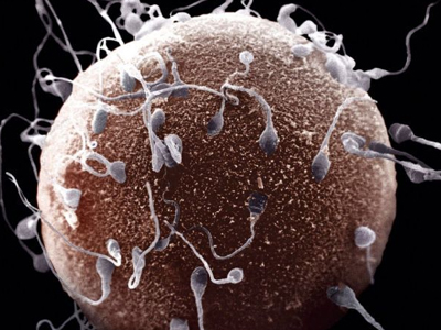 Νέα μέθοδος επιλογής σπερματοζωαρίων για την εξωσωματική γονιμοποίηση