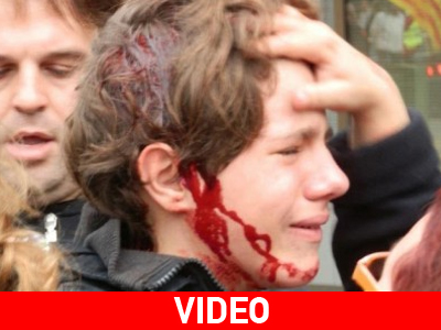 Σάλος στην Ισπανία από την ανελέητη επίθεση σε 13χρονο αγόρι