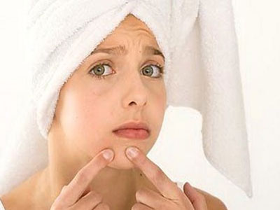 Έφηβες και ακμή