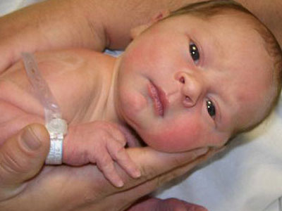 Οι γυναίκες που έχουν γεννηθεί καλοκαίρι έχουν λιγότερα παιδιά