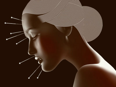 Βελονισμός κατά των ρυτίδων