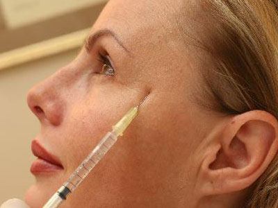 Όλα όσα πρέπει να ξέρετε για το botox