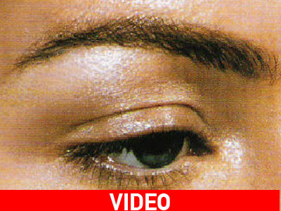 Αποτρίχωση στα φρύδια