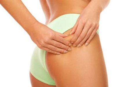 Η κυτταρίτιδα καιροφυλακτεί