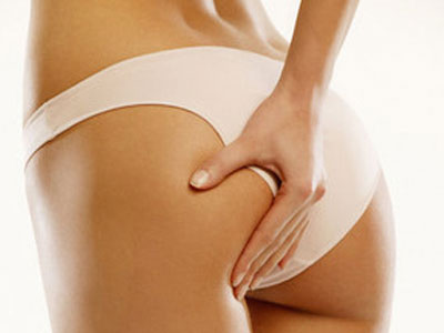 Η λιποαναρρόφηση υπό αμφισβήτηση