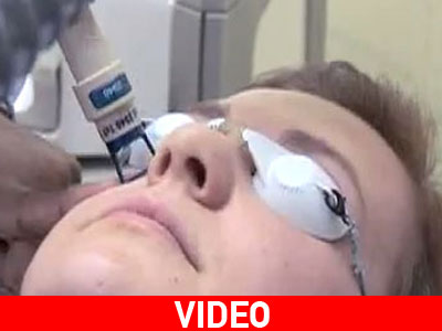 Nέα εφαρμογή Laser στην αισθητική