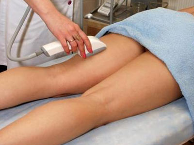 Λέϊζερ κατά της τριχοφυΐας