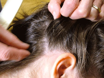 Ψείρες. Ο εφιάλτης ξαναχτυπά