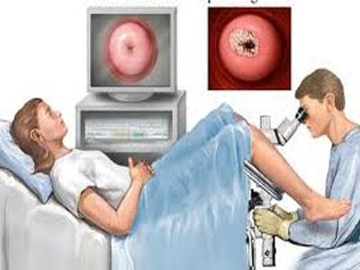 Σωτήριο το εμβόλιο για τον καρκίνο του τραχήλου της μήτρας