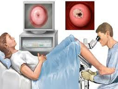 Κάντε τώρα τεστ για τον ιό των θηλωμάτων