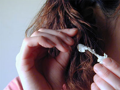 Τσίχλα στα μαλλιά