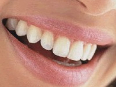 Αν δεν έχετε οδοντόκρεμα