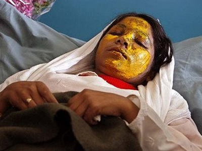 Φρίκη στο Αφγανιστάν με άγρια δολοφονία εφήβων