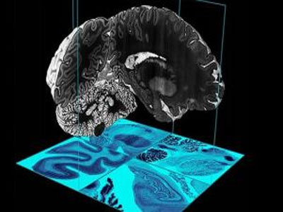 Ερευνητές δημιούργησαν τον λεπτομερέστερο ψηφιακό εγκέφαλο