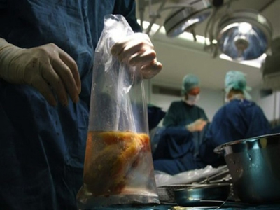 ‘Εκθεση-καταπέλτης της Ε.Ε για το εμπόριο οργάνων Σέρβων αιχμαλώτων στο Κόσοβο ‘Εκθεση-καταπέλτης της Ε.Ε για το εμπόριο οργάνων Σέρβων αιχμαλώτων στο Κόσοβο