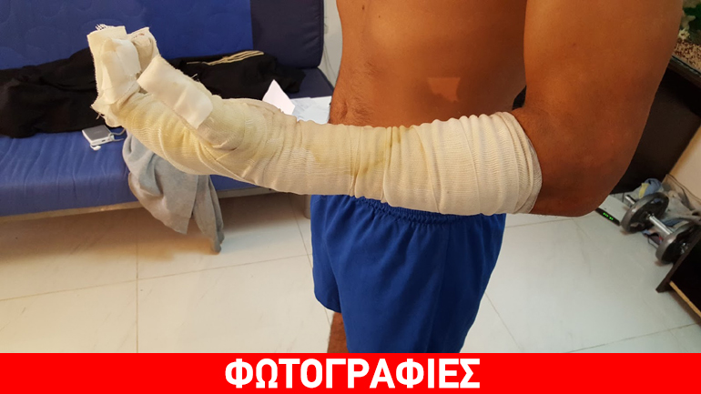 Τραυματισμός αστυνομικού από τις συμπλοκές στα Εξάρχεια