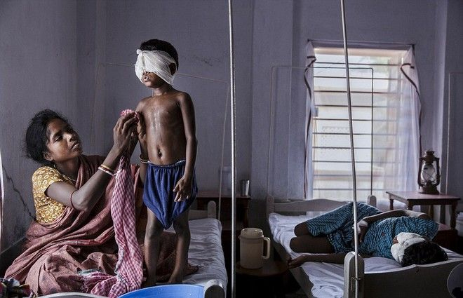 Μετά από την εγχείρηση για την αποκατάσταση της όρασης του μικρού αγοριού