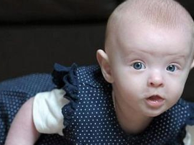 Γεννήθηκε χωρίς… αίμα!