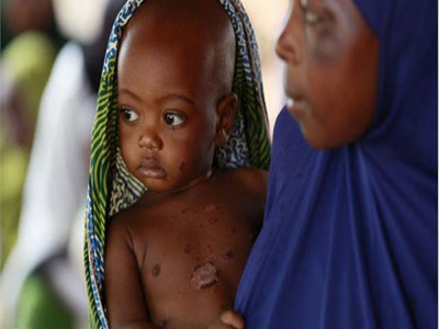 Στήριξη της UNICEF στα παιδιά που πλήττονται από τις συγκρούσεις στη Νιγηρία