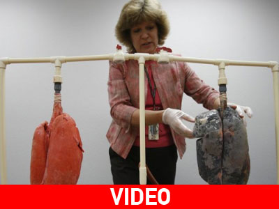 Πώς λειτουργεί ο πνεύμονας ενός καπνιστή; Σοκαριστική σύγκριση…