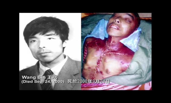 Η αφαίρεση των οργάνων -που θα πουληθούν μετά συνήθως κάπου στη Δύση- γίνονται ενώ ο 'δότης' είναι ακόμα ζωντανός