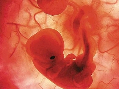 Μεσογειακή αναιμία: Νέα μέθοδος διάγνωσης στο έμβρυο