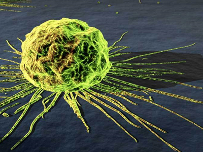 «Πάλεψε» με τρεις μορφές καρκίνου