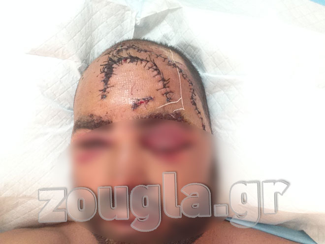 Ο ποδηλάτης που έπεσε θύμα της εγκληματικής αδιαφορίας